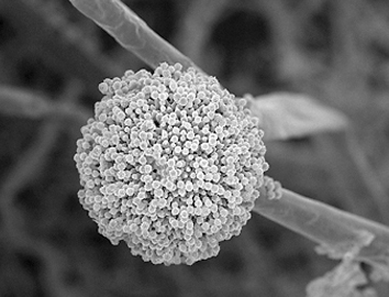 Scanning electron microscope image of Aspergillus niger